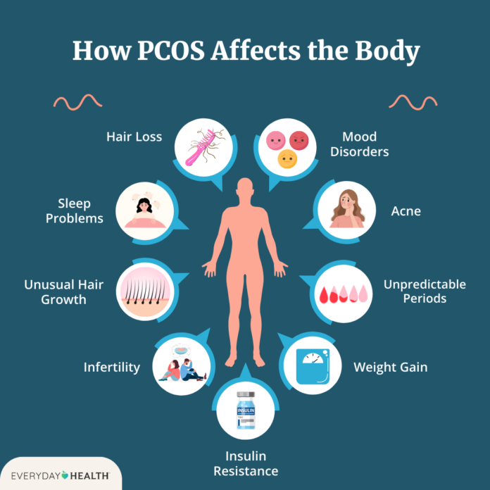 10 Subtle Signs That Could Indicate PCOS